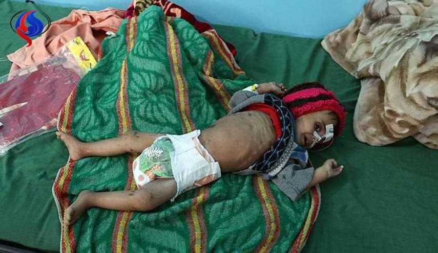 هر 10 دقیقه یک کودک یمنی می‌میرد!!