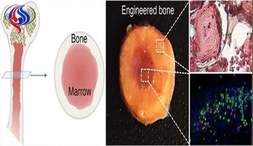تولید استخوان زیست‌مهندسی شده برای پیوند مغز استخوان