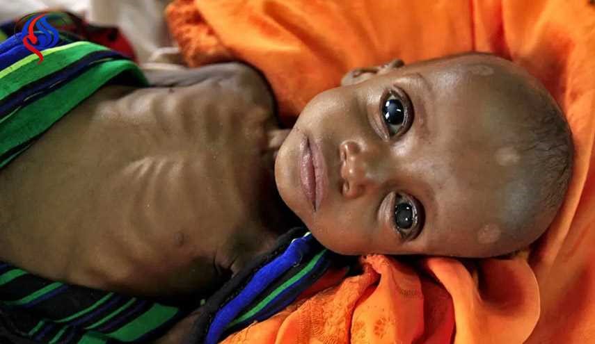 یونیسف: نیمی از مبتلایان به وبا در یمن کودک هستند