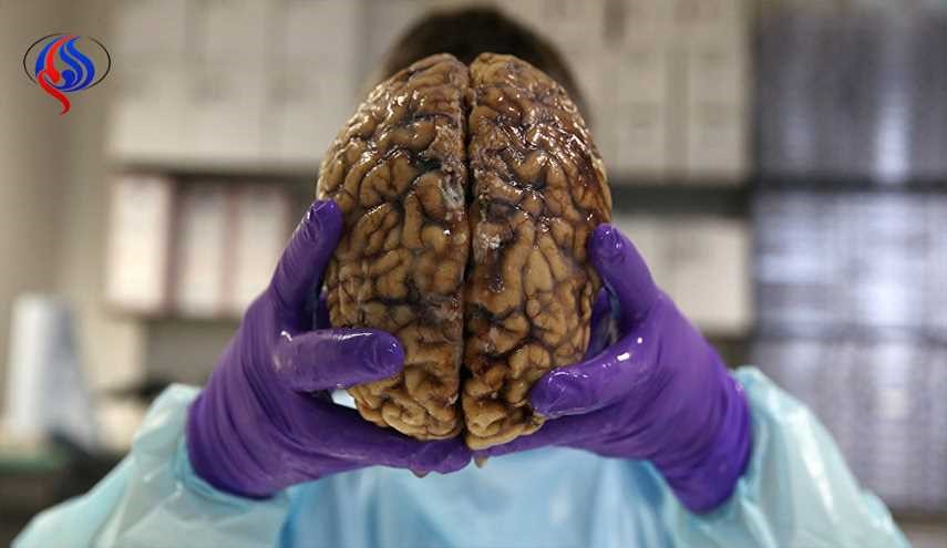 هذا هو أقدم دماغ اكتشفه علماء الاثار