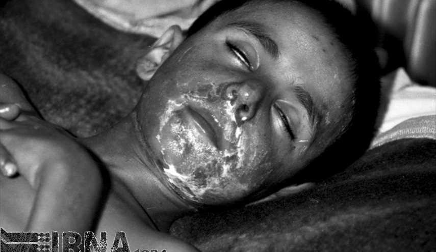 أغسطس 1988 - القصف الكيميائي لمنطقة أشنيفية / الصور