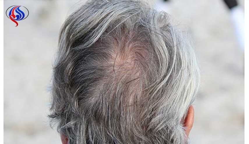 هل انتزاع الشعر الأبيض يؤدي إلى انتشاره؟