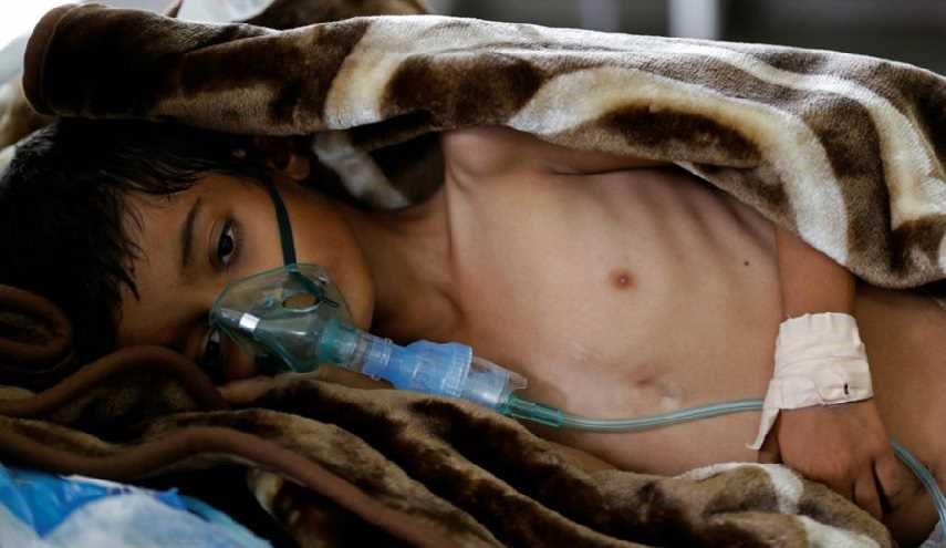 باحثون يكشفون كيف تورطت أميركا وبريطانيا بتفشي الكوليرا في اليمن