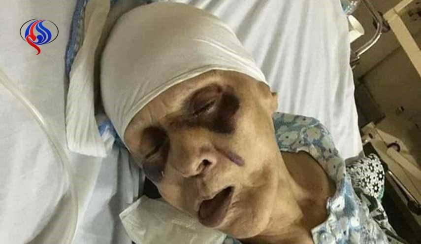 مسنة مصرية عذبها ابنها حتى الموت إرضاء لزوجته!