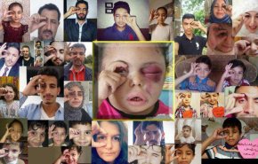 همدردی جهانی در شبکه های اجتماعی با دختر بچه یمنی+تصاویر