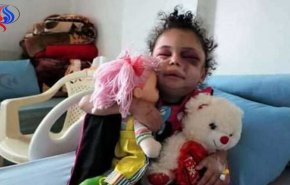 عربستان مسئول ربودن دختر بچه معروف یمنی است