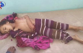 استشهاد طفلة يمنية في غارة سعودية / صور +18