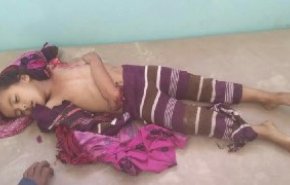 تصویری از شهادت دختربچه یمنی در حمله هوایی سعودی‌ها 18+