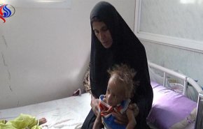 شاهد: من لم يموت جوعاً في اليمن.. ينتظره هذا المصير! 