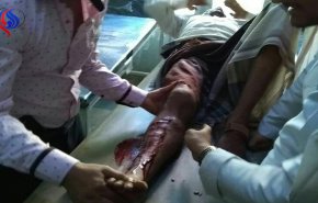 بالصور.. محاولة اغتيال أحد أقرباء نائب يمني تبوء بالفشل