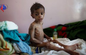 یونیسف: 400 هزار کودک یمنی با خطر مرگ مواجه هستند