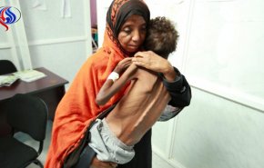 المجاعة في اليمن .. عار سيلاحق الإنسانية الى الأبد