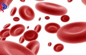 أعراض فقر الدم وأسباب الإصابة به