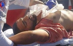 إصابة خطيرة لشاب فلسطيني برصاص الإحتلال في نابلس