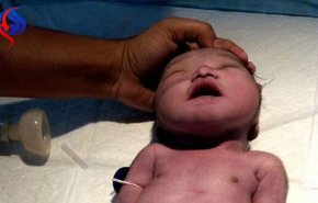 ولادة أول «حورية بحر» في الهند!! + صور