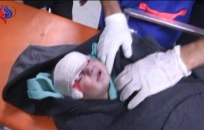 شاهد.. قناة العالم ترصد اوضاع المصابين في مستشفيات غزة
