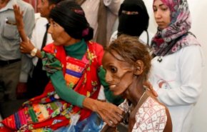 أوكسفام: اليمن يقترب نحو المجاعة أكثر من أي وقت مضى