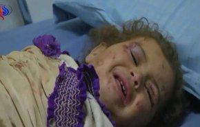 أطفال اليمن.. مأساة إنسانية كبرى بعد ألف يوم من العدوان