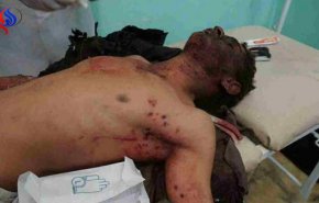 بالصور؛مجزرة للعدوان باستهداف سيارات أجرة قرب صنعاء