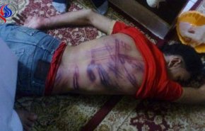  تعذيب المدافعين عن حقوق الإنسان والنشطاء في البحرين