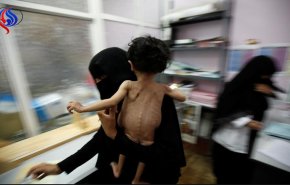 کمبود شدید دارو در استان صنعاء یمن 