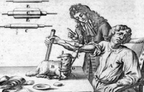 أول عملية في التاريخ.. نقل دم خروف إلى إنسان في القرن الـ17 !!
