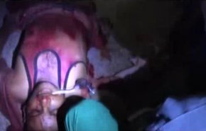 بالفيديو: هذا ما كشفته ازيز طائرات العدوان السعودي على مستشفى الحديدة
