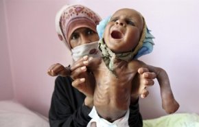 الوضع الإنساني في اليمن عشية بدء مفاوضات جنيف