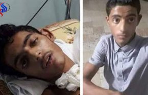 استشهاد طفل متأثرًا بإصابته برصاص الاحتلال شرق خان يونس
