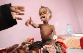 مأساة اليمن ..أبعد من جرائم حرب في ظل التناقضات الامريكية