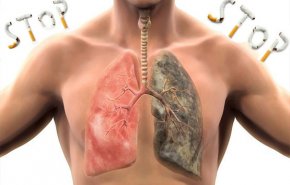 وصفة سحرية تخلص الرئتين من السموم وتساعد على الإقلاع عن التدخين!