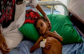رحيل الطفلة التي فتحت عيون العالم على مأساة اليمن