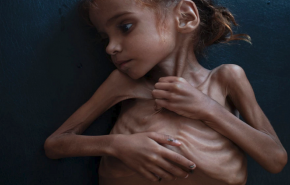شاهد.. قصة الطفلة اليمنية 