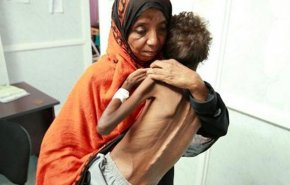 الصحة العالمية: الشعب اليمني بات على حافة المجاعة