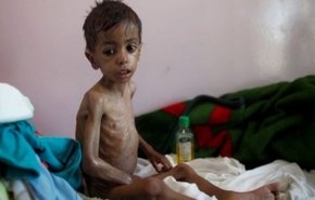 احتمال مرگ 85 هزار کودک یمنی بر اثر گرسنگی و قحطی