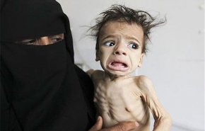 سناتور آمریکایی: ۸۵۰۰۰ کودک یمنی از گرسنگی جان باخته‌اند