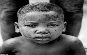 بالصور.. تشويه وجوه الأطفال في قبائل غرب أفريقيا