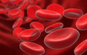 تطبيق يكشف فقر الدم بدون دم
