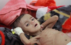 شاهد؛ منظمات دولية تحذر من مجاعة تهدد 20 مليون يمني 
