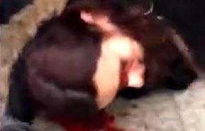 تصاویر منتشر شده از کور شدن چشم یک دختر فرانسوی بر اثر شلیک پلیس