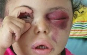 آل سعود بثینه دختر 5 ساله یمنی را آزاد کرد + فیلم
