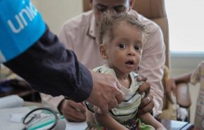 باحثون.. وباء الكوليرا فى اليمن منشأه هذه القارة؟