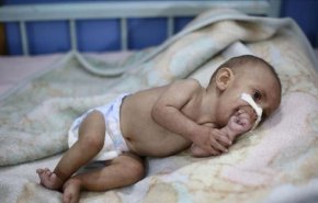 مسؤول أممي: اتفاق السويد لم يطعم طفلا يمنيا واحدا