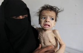 هر یک ساعت 6 کودک یمنی به دلیل سوء تغذیه جان خود را از دست می‌دهند