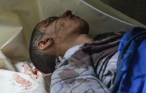 32 شهيدا وجريحا في غارات للعدوان وسط العاصمة صنعاء