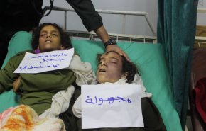 الشامی: همدستی سازمان ملل با متجاوزان در کشتار صنعاء
