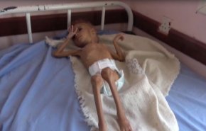الصحة العالمية: تعرض جيل كامل في اليمن للخطر لهذا السبب