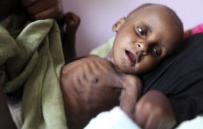 یونیسف: هر دو ساعت یک مادر و ۶ نوزاد در یمن می‌میرند