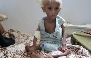 اكثر من 24 مليون يمني بحاجة للمساعدات