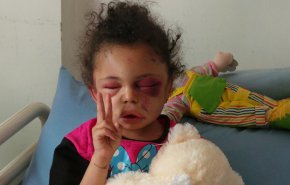 حال و روز کودکان یمنی پس از چند سال تجاوز عربستان+فیلم